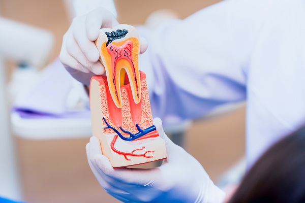 Painless Root Canal Treatment